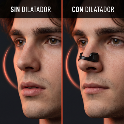 TNE® - Dilatador Nasal · Kit 30 días